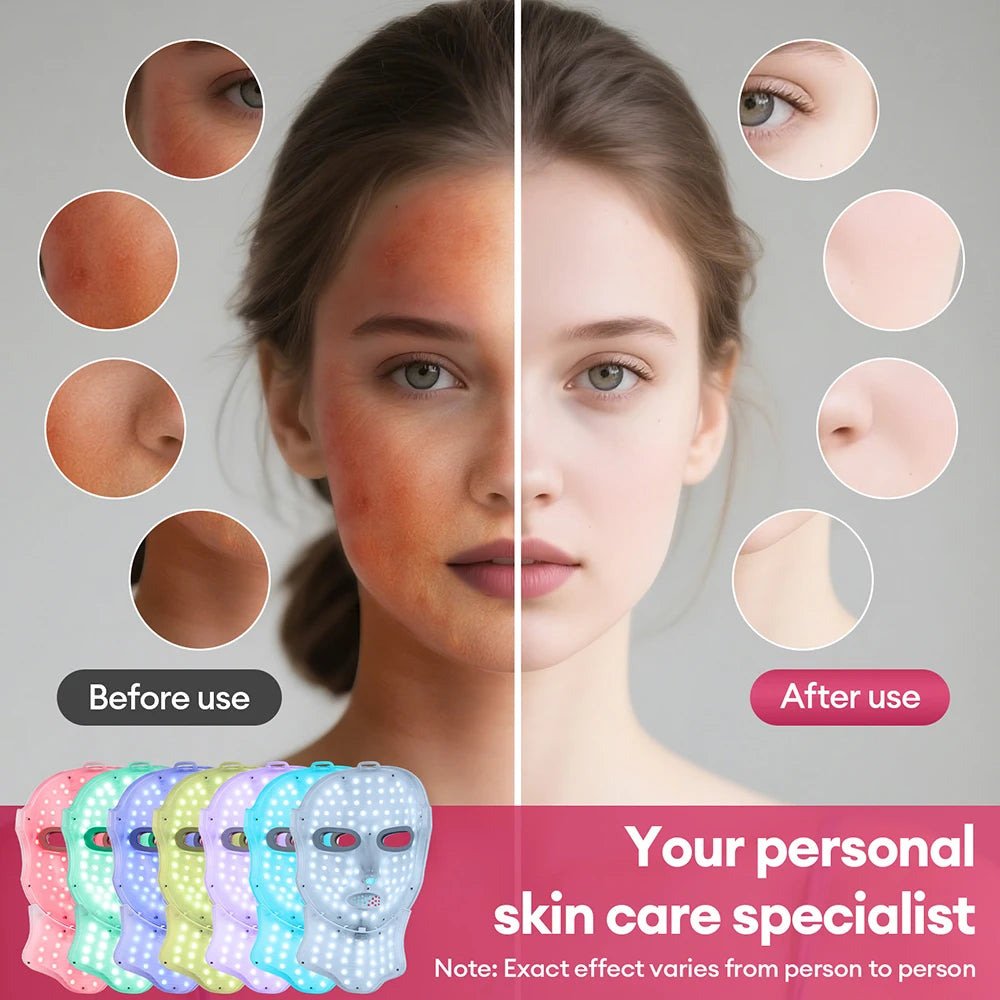 Wireless LED Face & Neck Mask
