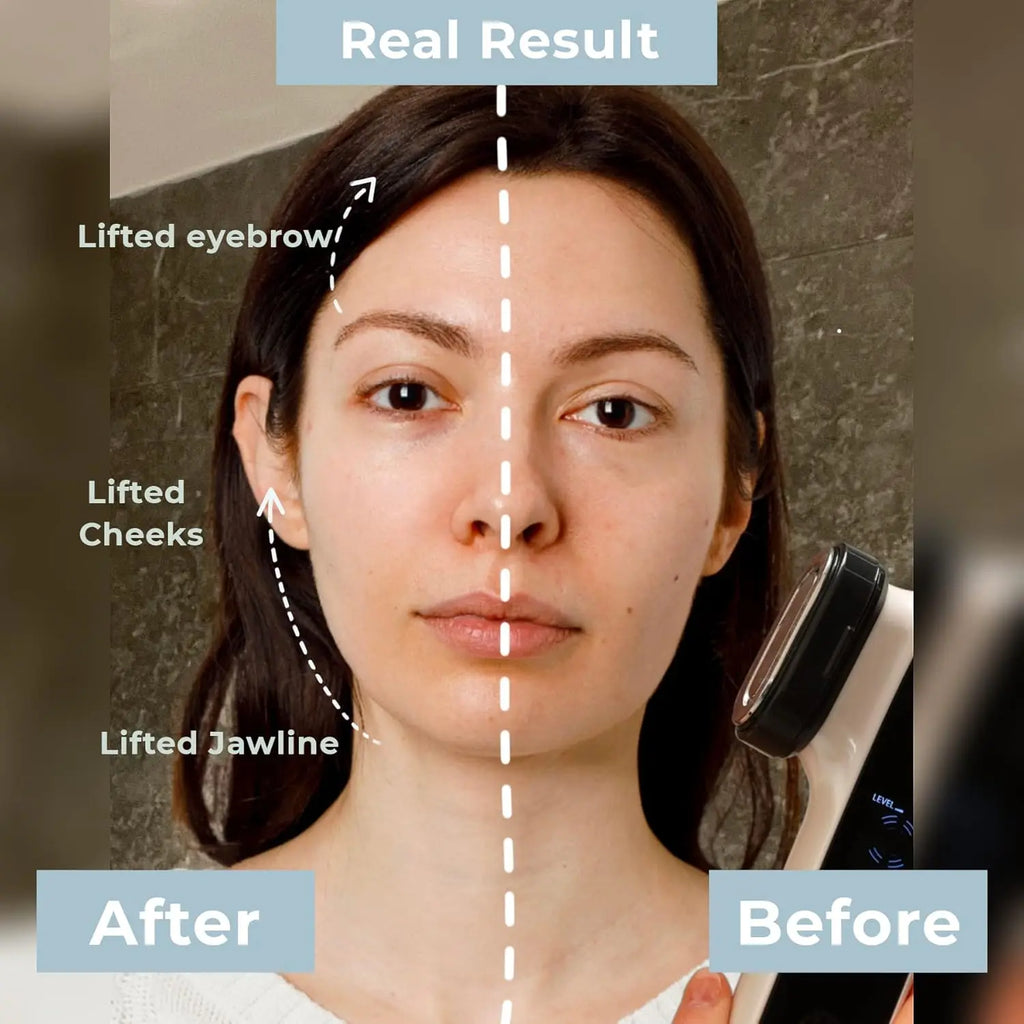 6-in-1 Anti-Aging Device