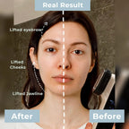 6-in-1 Anti-Aging Device