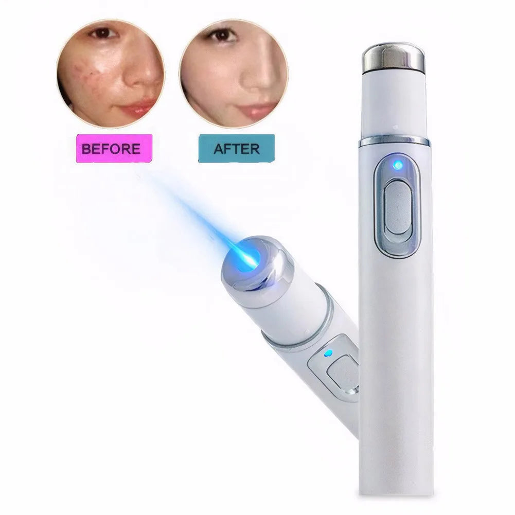 Blue Light Acne Pen