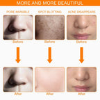 LED Facial Mask 7 Colors